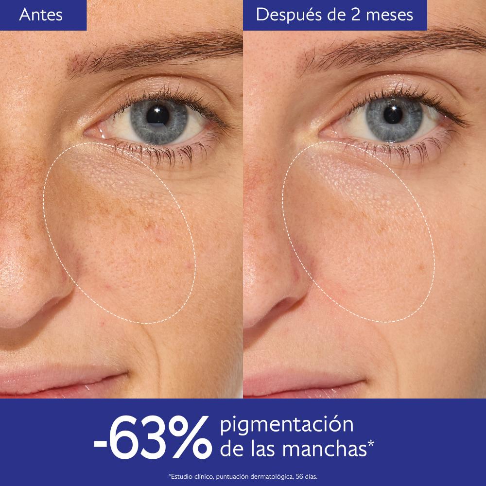 VINOPERFECT ANTIMANCHAS SET (SET ANTIMANCHAS)